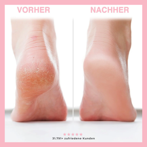 FRAMI FootGlow – Weil deine Füße mehr verdienen!