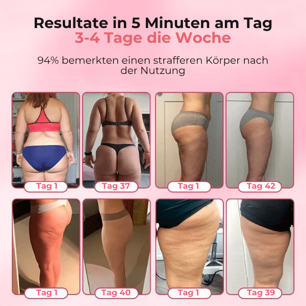 FRAMI SheVitality - Anti-Cellulite Schröpfen Massagegerät