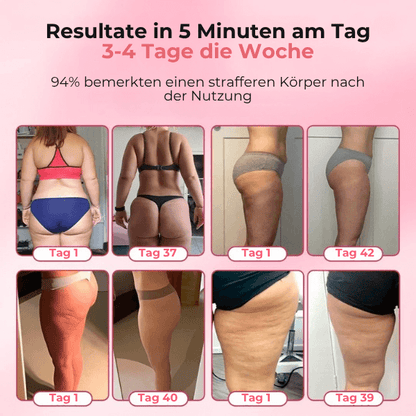 FRAMI SheVitality - Anti-Cellulite Schröpfen Massagegerät
