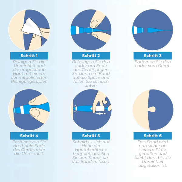 FRAMI DermaLift 2-in-1 - Das Hautanhängsel Entfernungs-Set