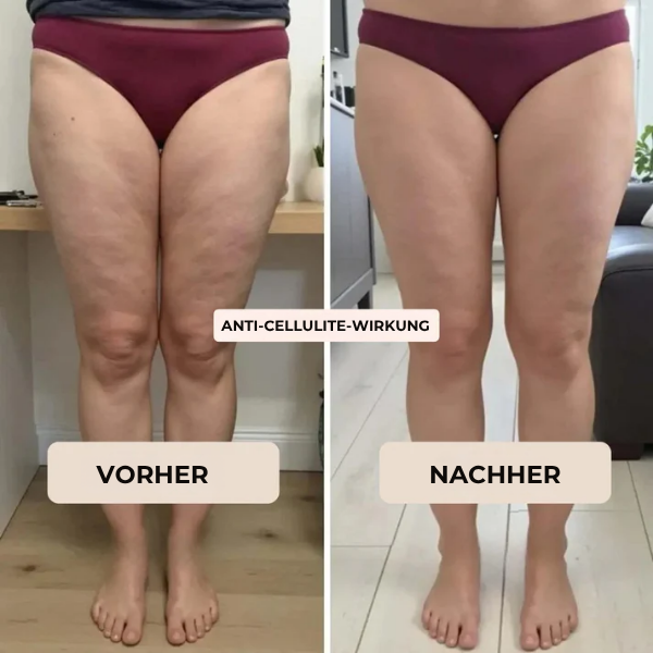 FRAMI ActiveShape™ Kompression für mehr Straffung