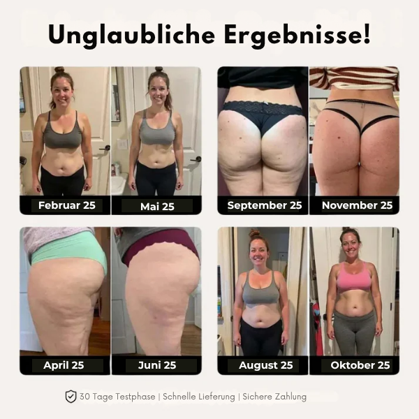 FRAMI ActiveShape™ Kompression für mehr Straffung