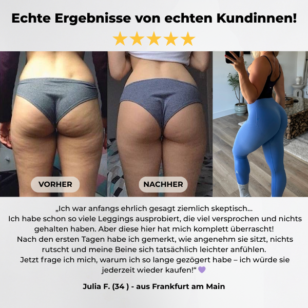 FRAMI ActiveShape™ Kompression für mehr Straffung