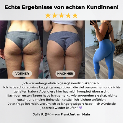 FRAMI ActiveShape™ Kompression für mehr Straffung