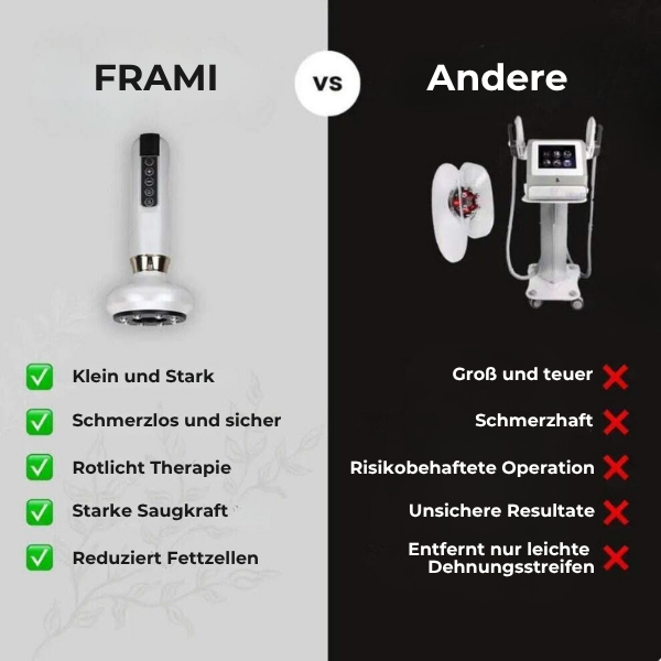FRAMI SheVitality - Anti-Cellulite Schröpfen Massagegerät